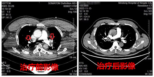 治疗前后对比图_副本.jpg