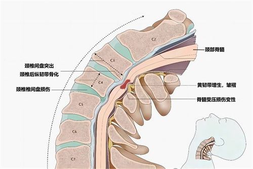 图解.jpg