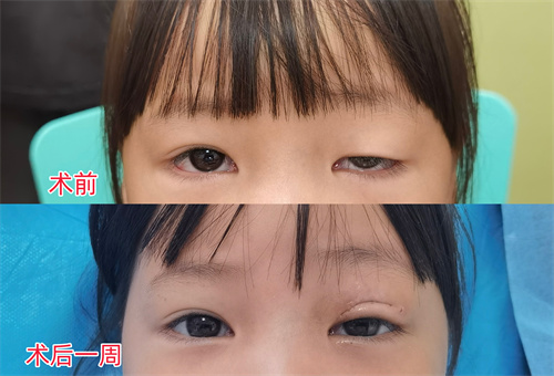 术前术后对比图.jpg